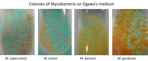 Colonies of Mycrobacteria on Ogawa's medium